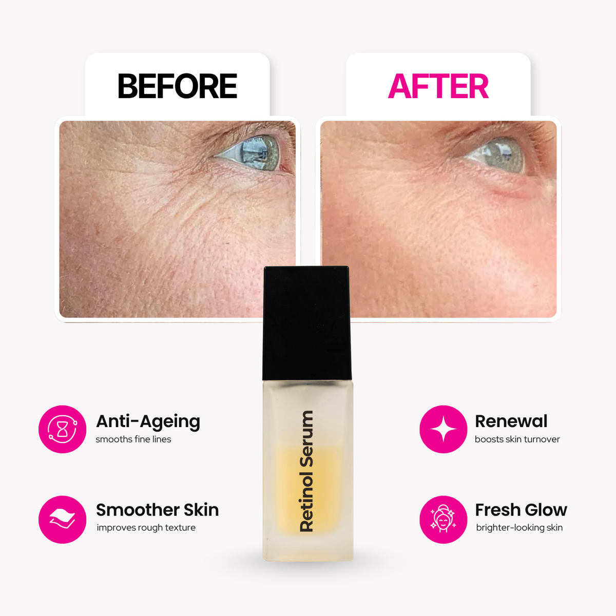 Retinol Serum