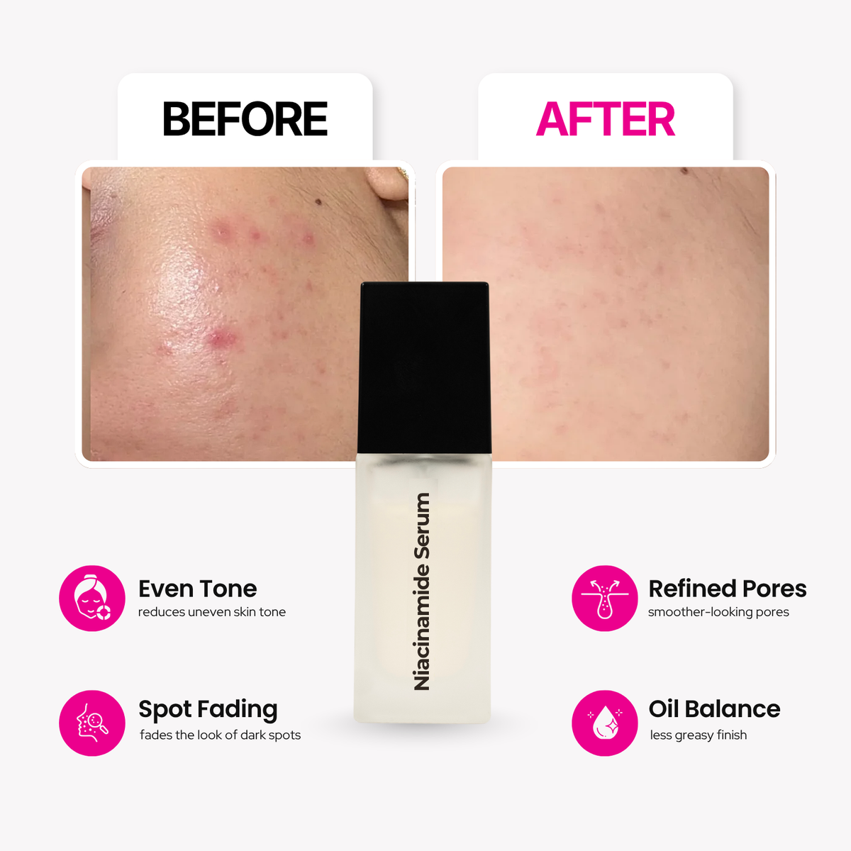 Niacinamide Serum